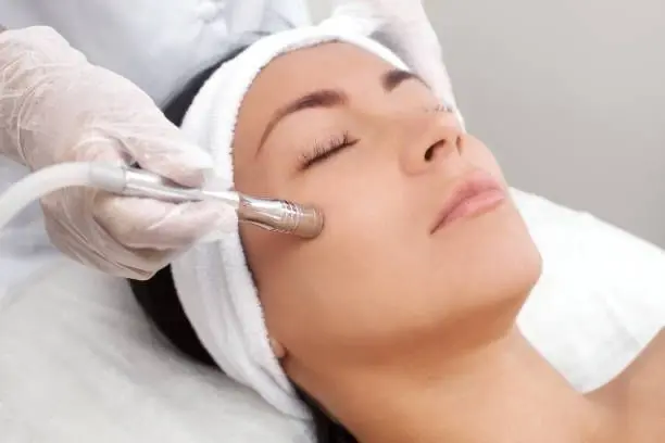 Microdermabrasion (x4)