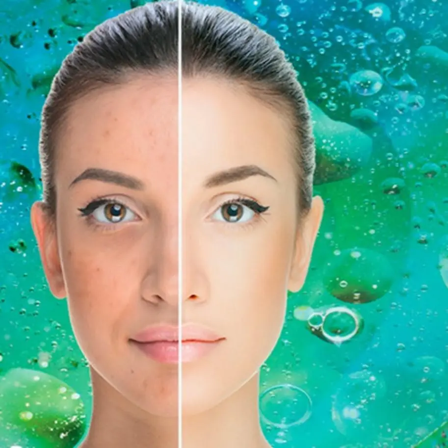 Peeling BioRepeel (x4)